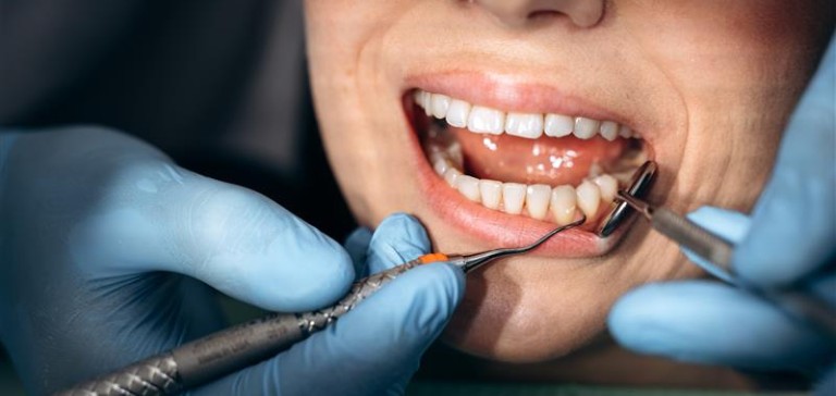 Preventing Gum Disease: What Every Patient Should Know